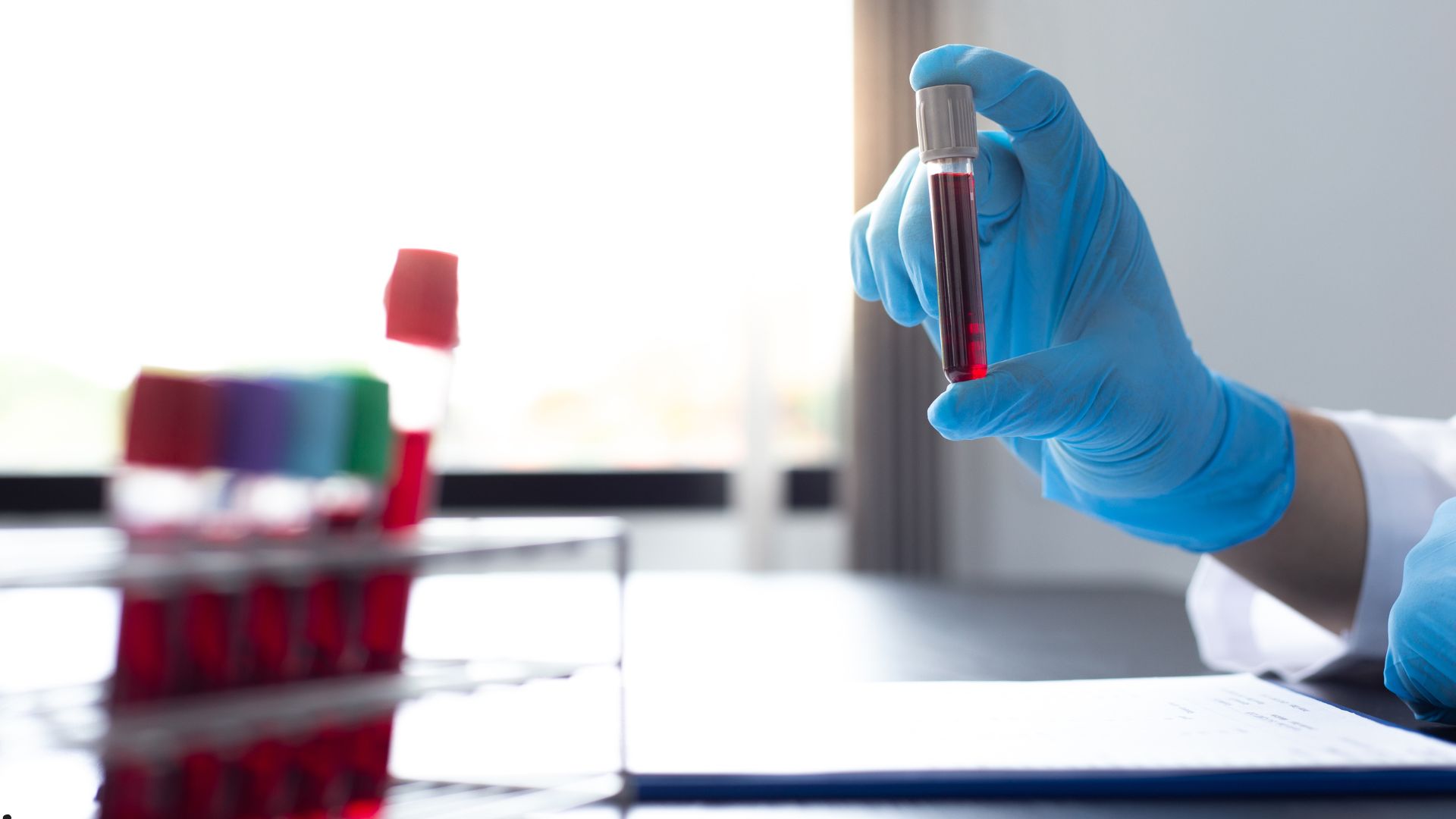 Ayaq şişməsi diaqnozu