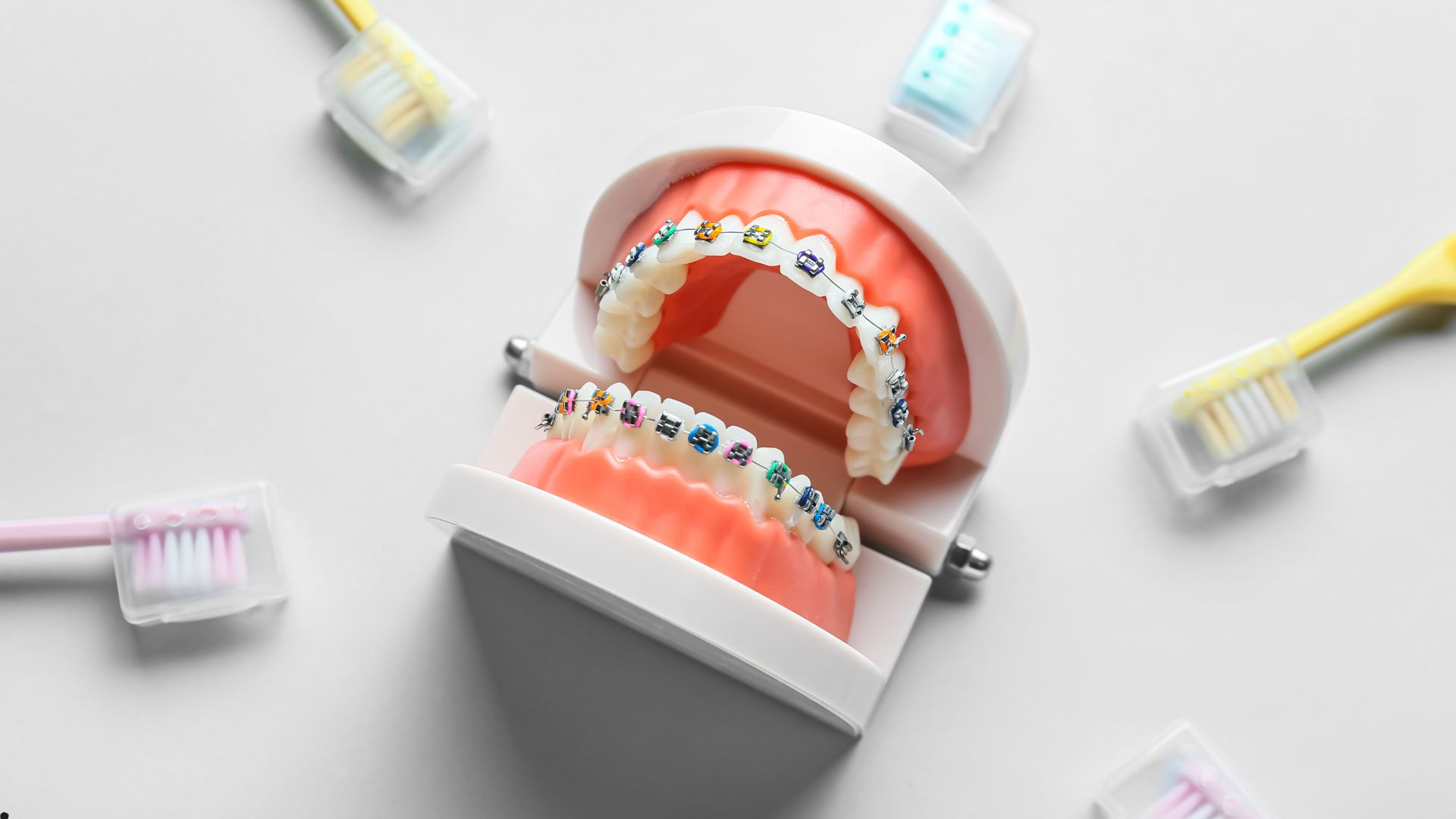 Breket taxıldıqdan sonra ağız baxımı