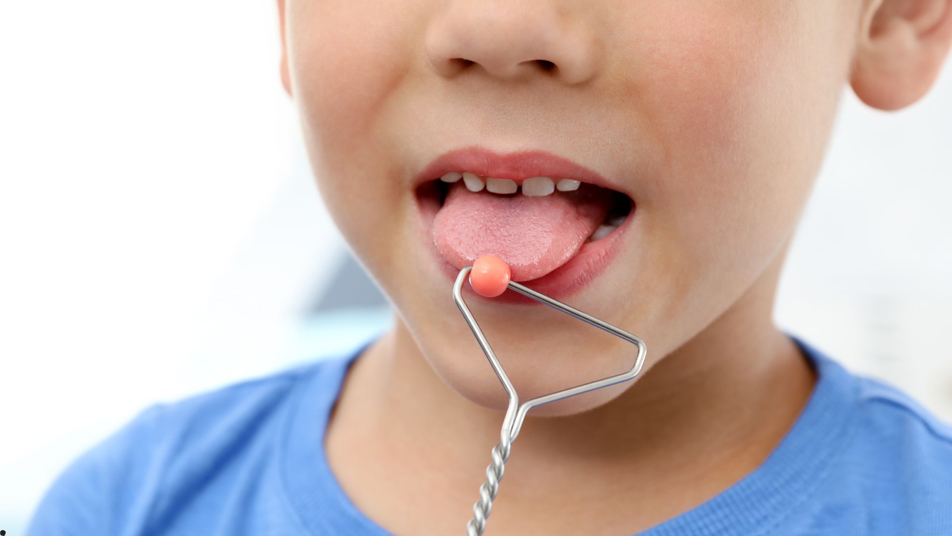 Dilin topuq vurması