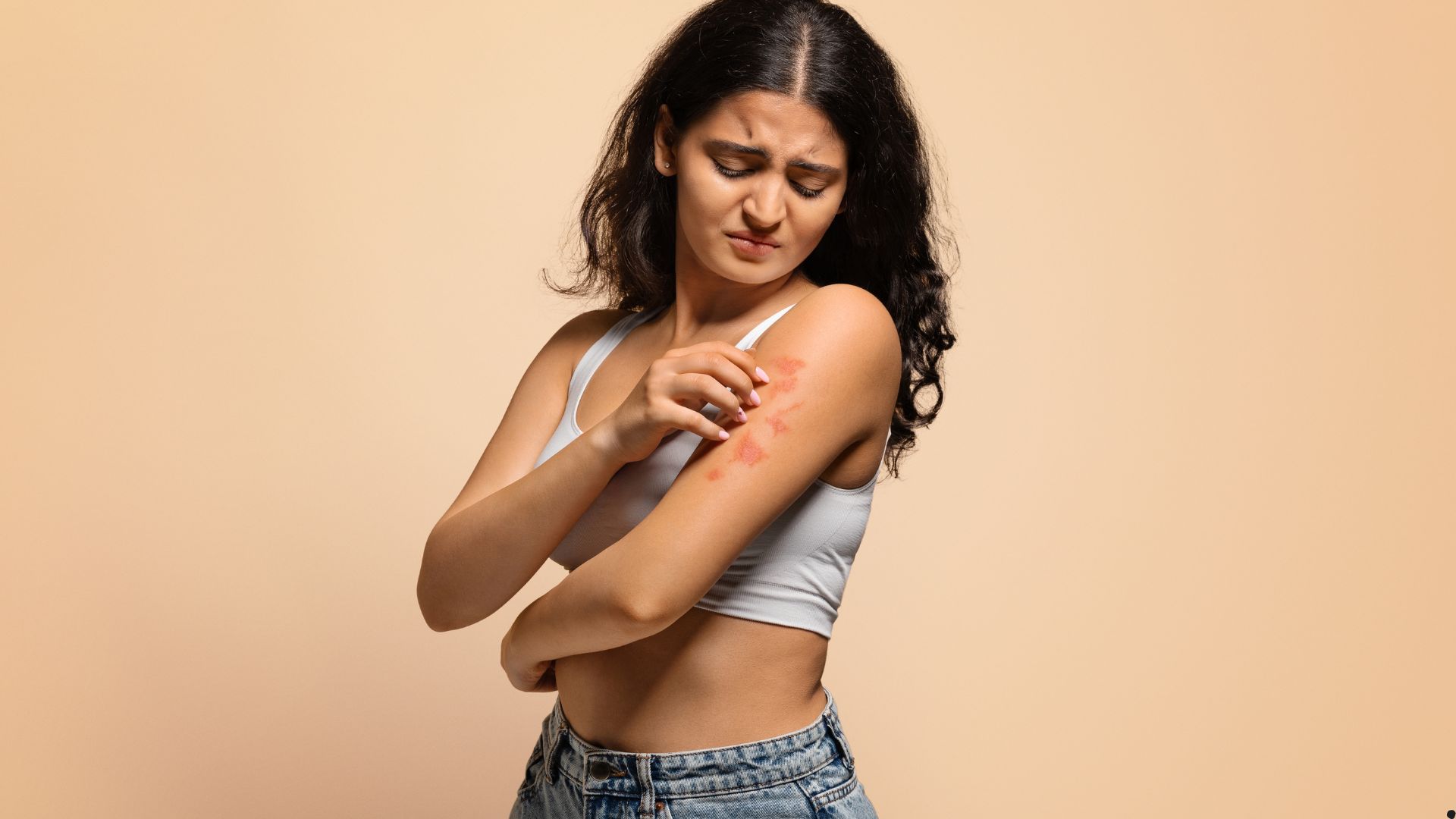 Gün işığı allergiyası