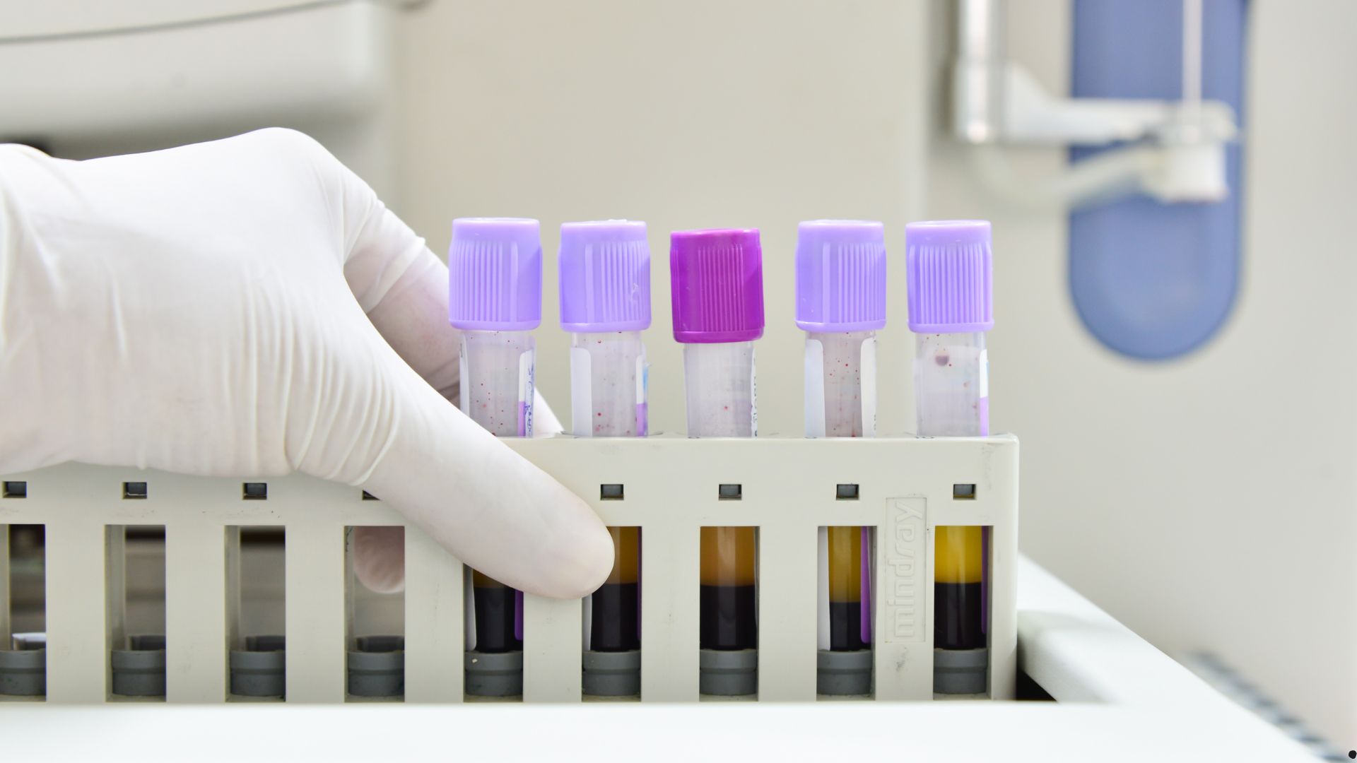 Yaz allergiyası diaqnostikası