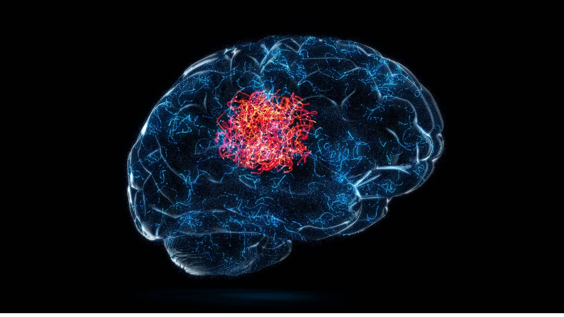 beyində şişin böyüməsi