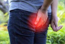 Babasil (Hemorrhoid) nədir? müalicəsi və əməliyyatı