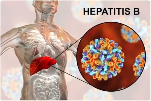 Hepatit B. Əlamətləri, Təsirləri və Müalicəsi