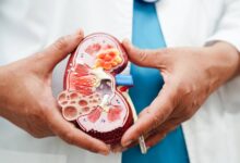 Böyrək Daşlarının Yaranma Səbəbləri. Böyrək Daşlarının Əlamətləri. Böyrək iltihabı. Böyrək ağrısının evdə müalicəsi üçün tövsiyələr