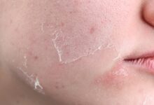 quru deri nemlendirme