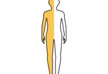 Hemiplegiya