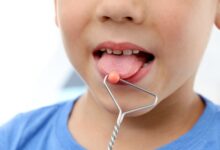 Dilin topuq vurması