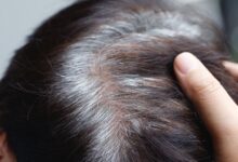 Saçların tez ağarması