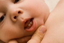 Uşaqlarda diş çıxarma dövrü