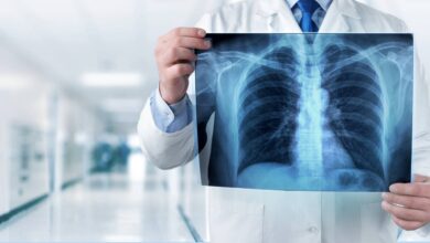 arterial hipertoniya