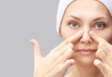 burun çəpər əyriliyi