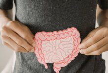 Sızan Bağırsaq Sindromu