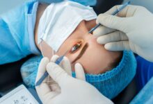 Keratopiqmentasiya nədir