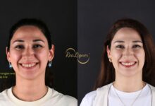 Ortodontik Klinika və Ortodont Həkim Necə Seçilməlidir?