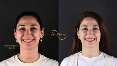 Ortodontik Klinika və Ortodont Həkim Necə Seçilməlidir?